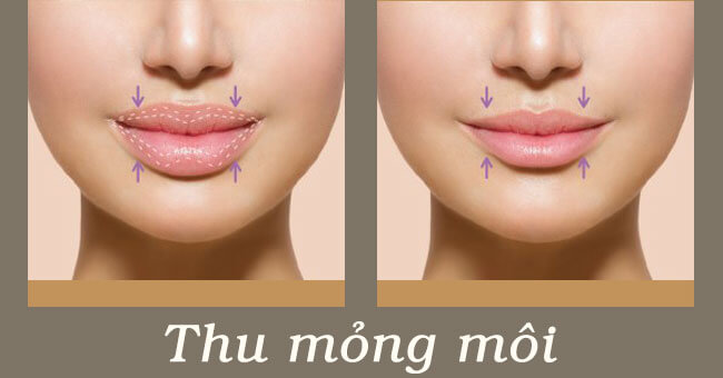 Thu mỏng môi