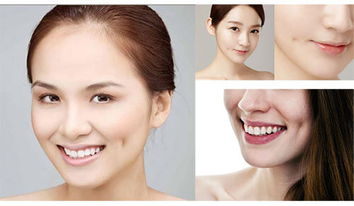 Ưu điểm sau khi tạo má lúm đồng tiền